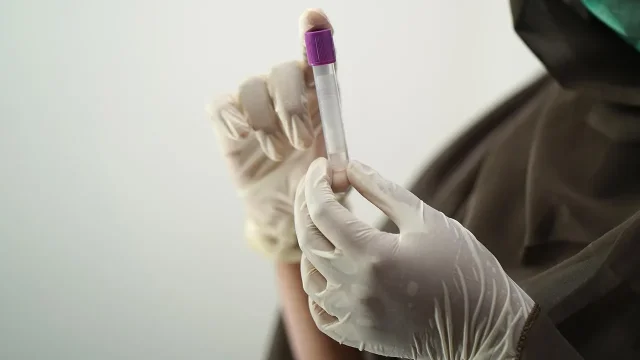 découvrez comment améliorer la conversion de vos diagnostics grâce à des conseils pratiques, des outils performants et des stratégies efficaces pour optimiser vos résultats.